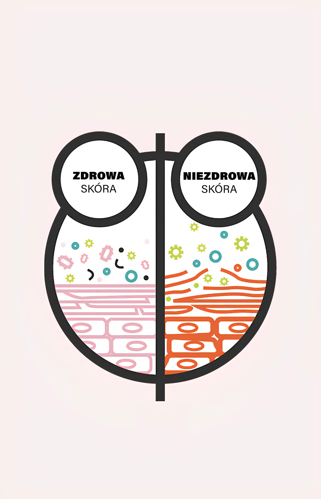Ilustracja pokazująca różnicę między zdrową a niezdrową skórą.