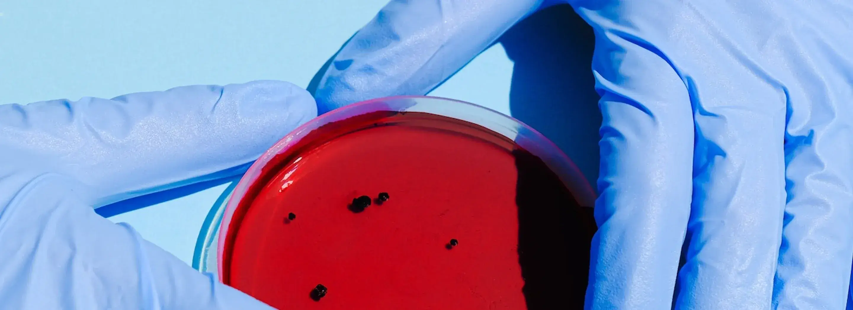 Szalka Petriego z hodowlą bakterii &ndash; badania nad skutecznością probiotyk&oacute;w YUN Probiotherapy