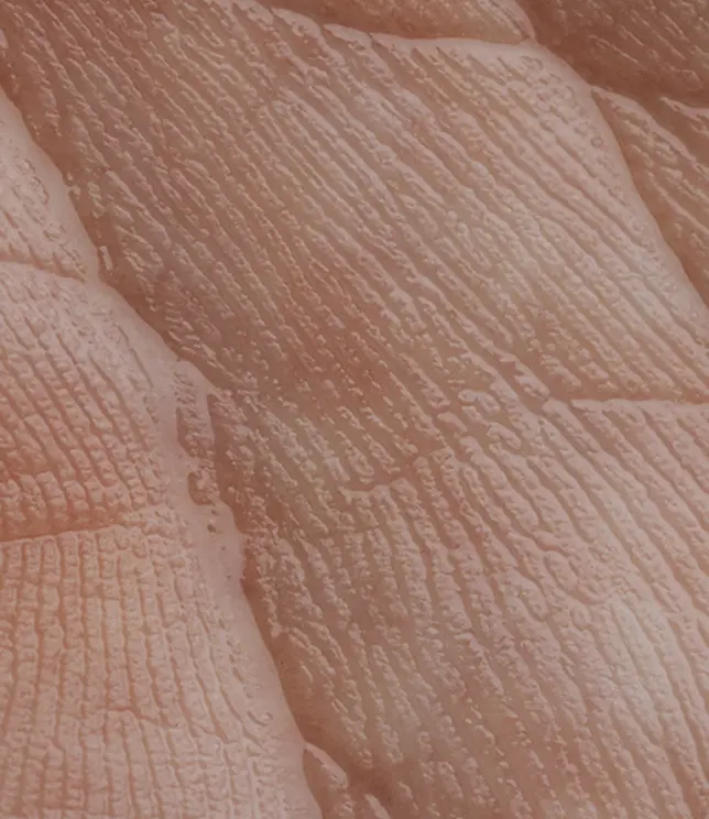 Zbliżenie na sk&oacute;rę twarzy z niedoskonałościami.