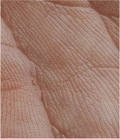 ROLA KULTUR BAKTERII LACTOBACILLUS W ZATRZYMYWANIU ROZWOJU PATOGENÓW SKÓRY